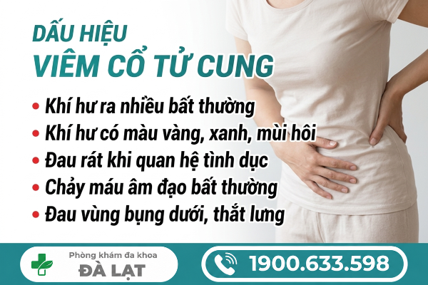 Hình ảnh minh họa